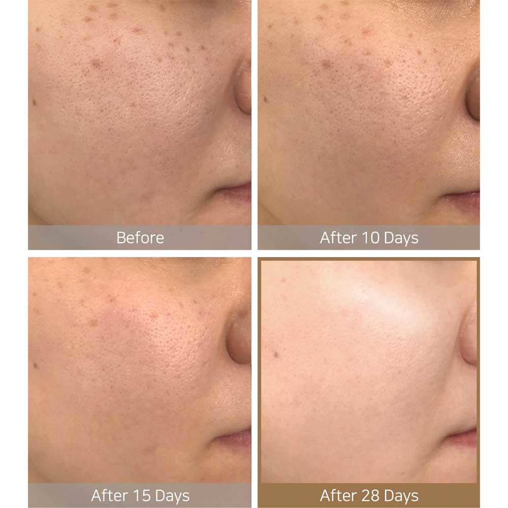 Galactomyces Pure Vitamin C Glow Serum