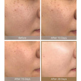 Galactomyces Pure Vitamin C Glow Serum